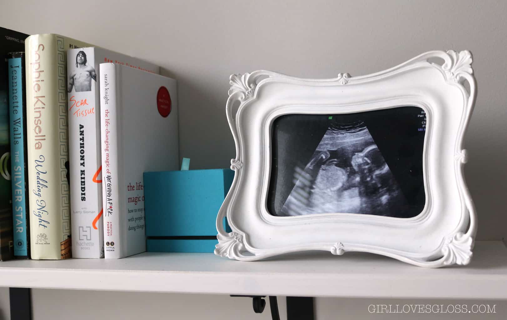 40 Weeks Pregnant Recap