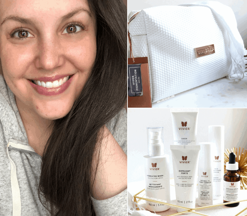 Introduction to Vivier Skincare and my First Chemical Peel